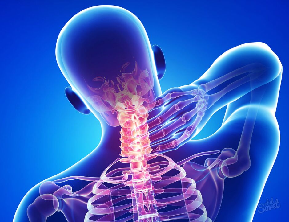 dzemdes kakla osteohondroze
