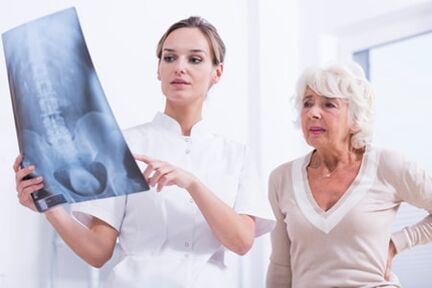 Ārsts parāda pacientam X -ray attēls ar mugurkaulu