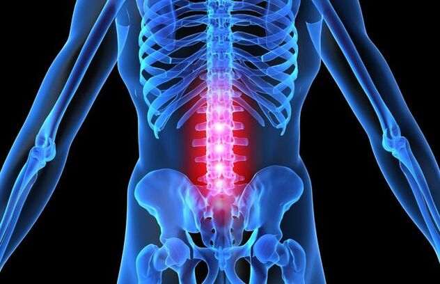 Mugurkaula jostas daļas osteohondrozes progresējošā stadijā pasliktinās cilvēka motoriskā aktivitāte. 
