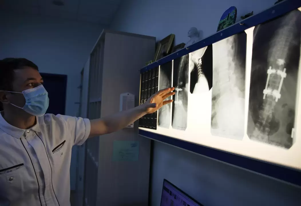 Ārsti diagnosticē dzemdes kakla osteohondrozi, izmantojot instrumentālās metodes, piemēram, rentgenogrāfiju